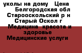 уколы на дому › Цена ­ 400 - Белгородская обл., Старооскольский р-н, Старый Оскол г. Медицина, красота и здоровье » Медицинские услуги   